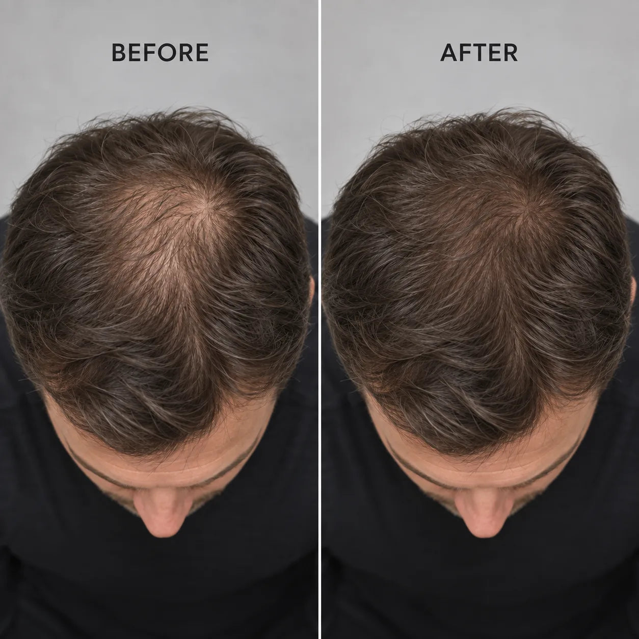 Hair density before and after comparison