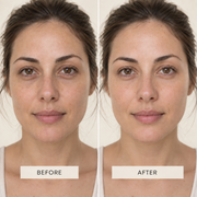 RadiaAura™ Lumina LED Face Mask